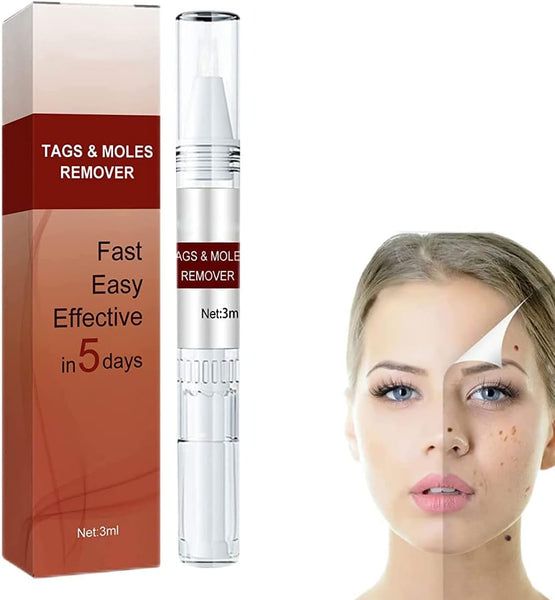 West&Month™ — Moles & Skin Tags Remover